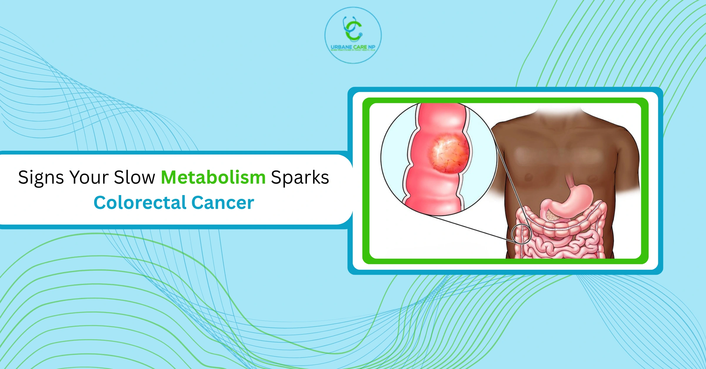 Signs Your Slow Metabolism Sparks Colorectal Cancer