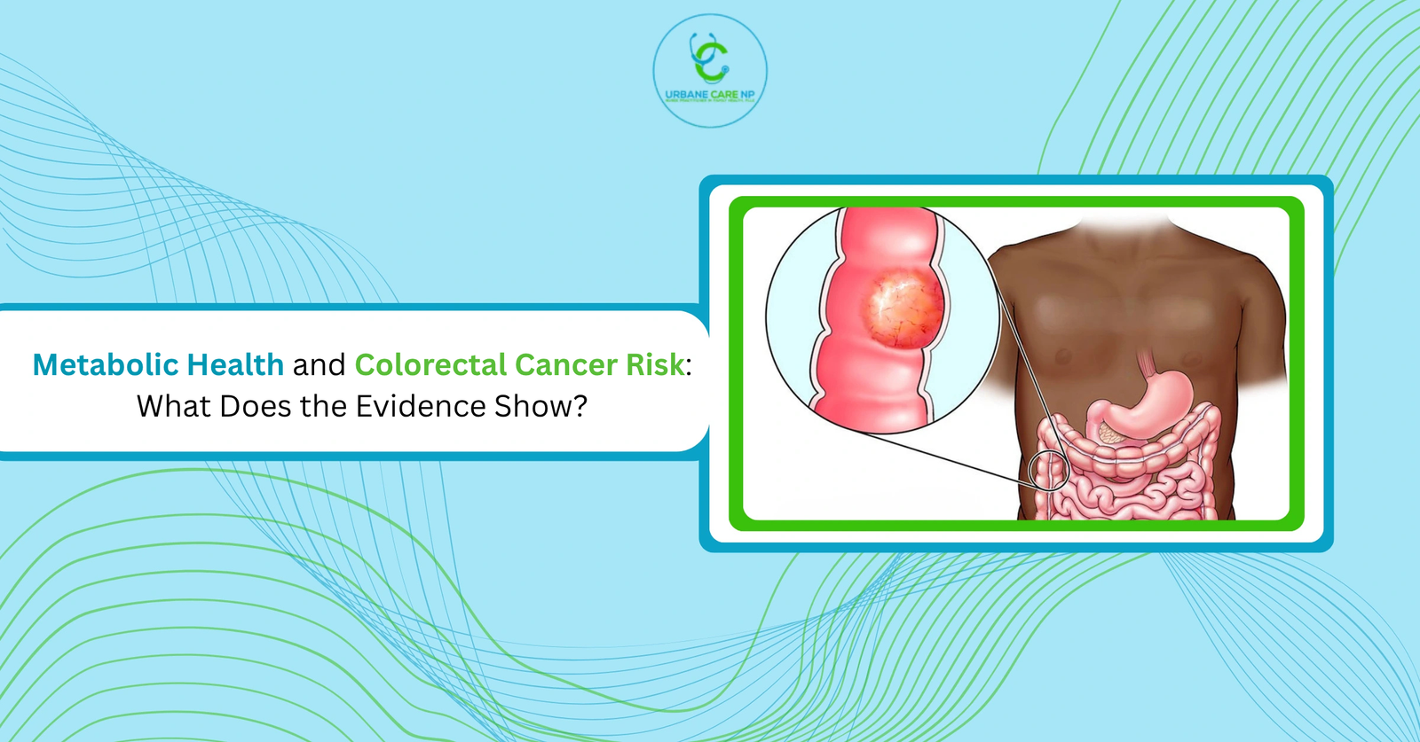 Metabolic Health and Colorectal Cancer Risk: What Does the Evidence Show?